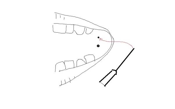 dimple2.jpg